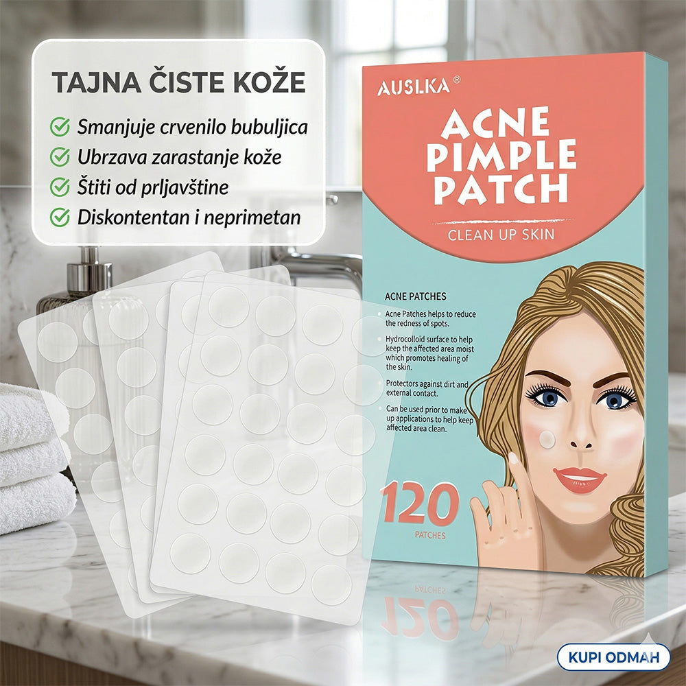 Flasteri za bubuljice – nestaju preko noći